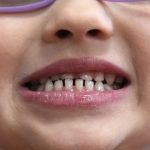 U.S. Clarifies Nature of Nuclear Weapons Tests: No Explosions Planned