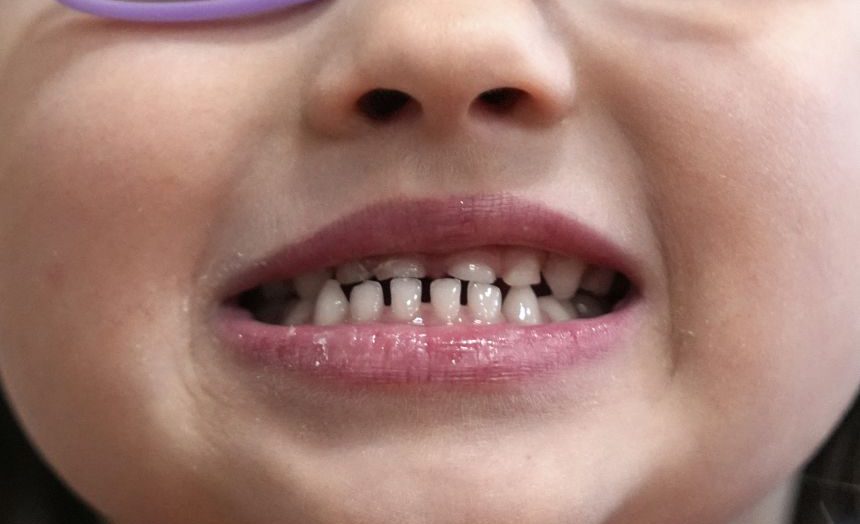 FDA Issues Warnings Over Unapproved Fluoride Products for Children