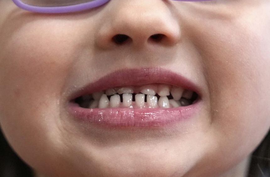 FDA Issues Warnings Over Unapproved Fluoride Products for Children